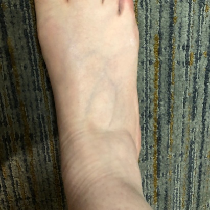 Right foot (normal size)